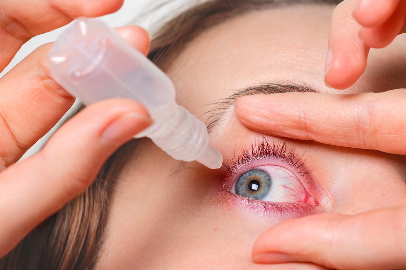 Rimedi per occhi secchi: colliri efficaci e naturali