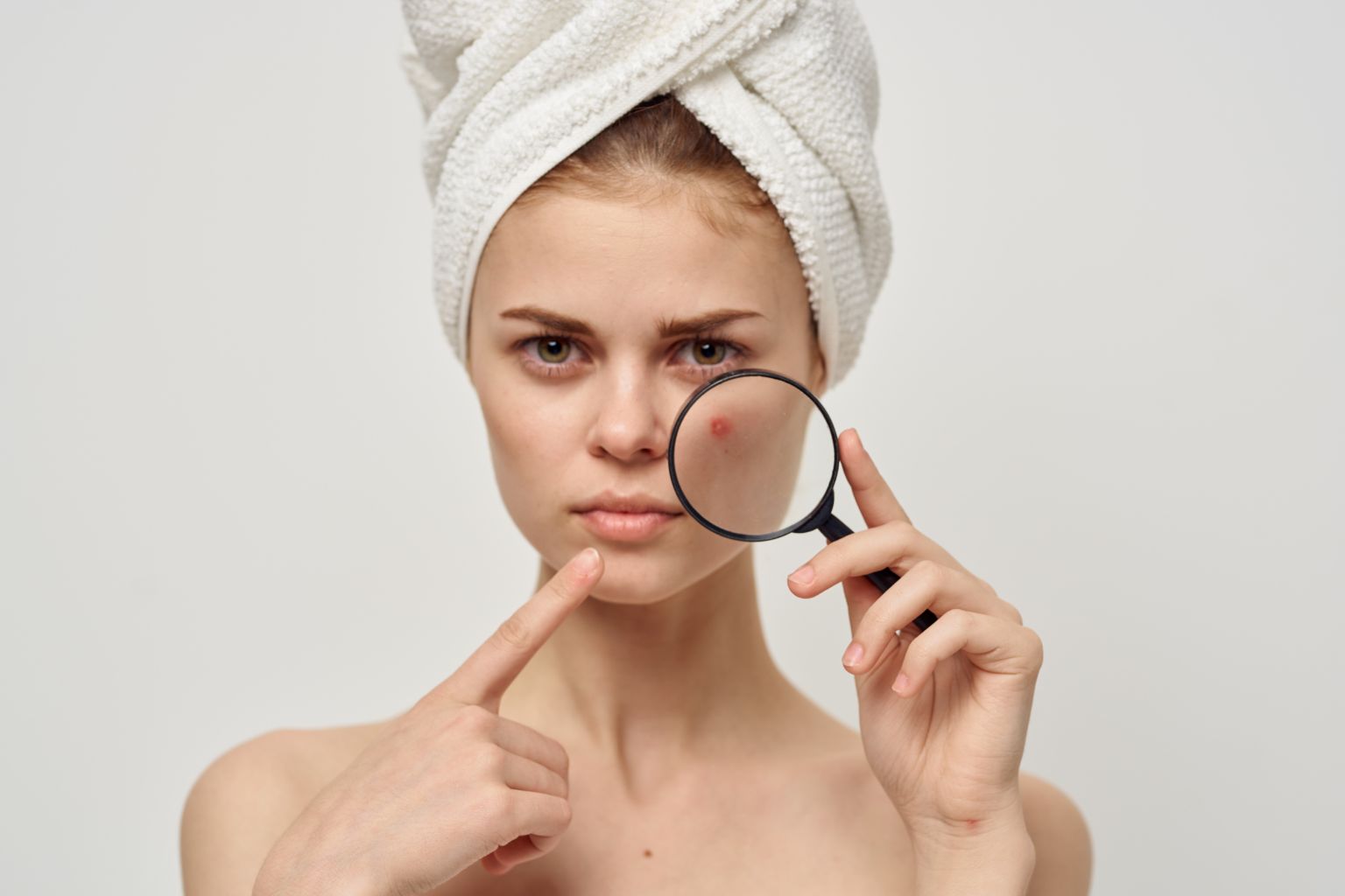 Pelle a tendenza acneica: cause e rimedi