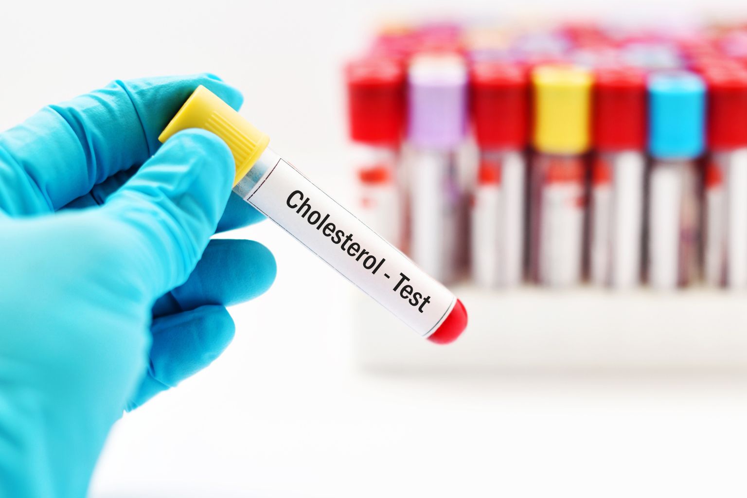 Integratori per colesterolo: quando assumerli